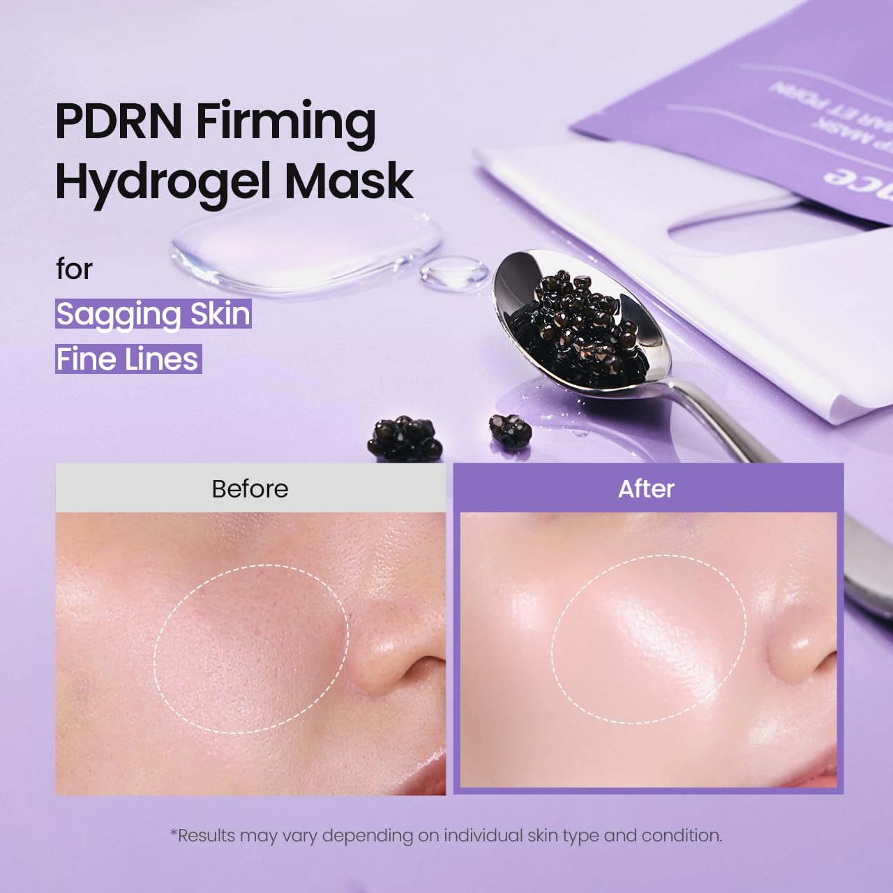BIODANCE Intensive Caviar PDRN Set: Caviar PDRN Jelly Capsule Cream (1.69 fl.oz) & Skin Barrier Mask (4 Sheets), Salmon DNA Skin Care Set for Deep Nourishment & Radiance