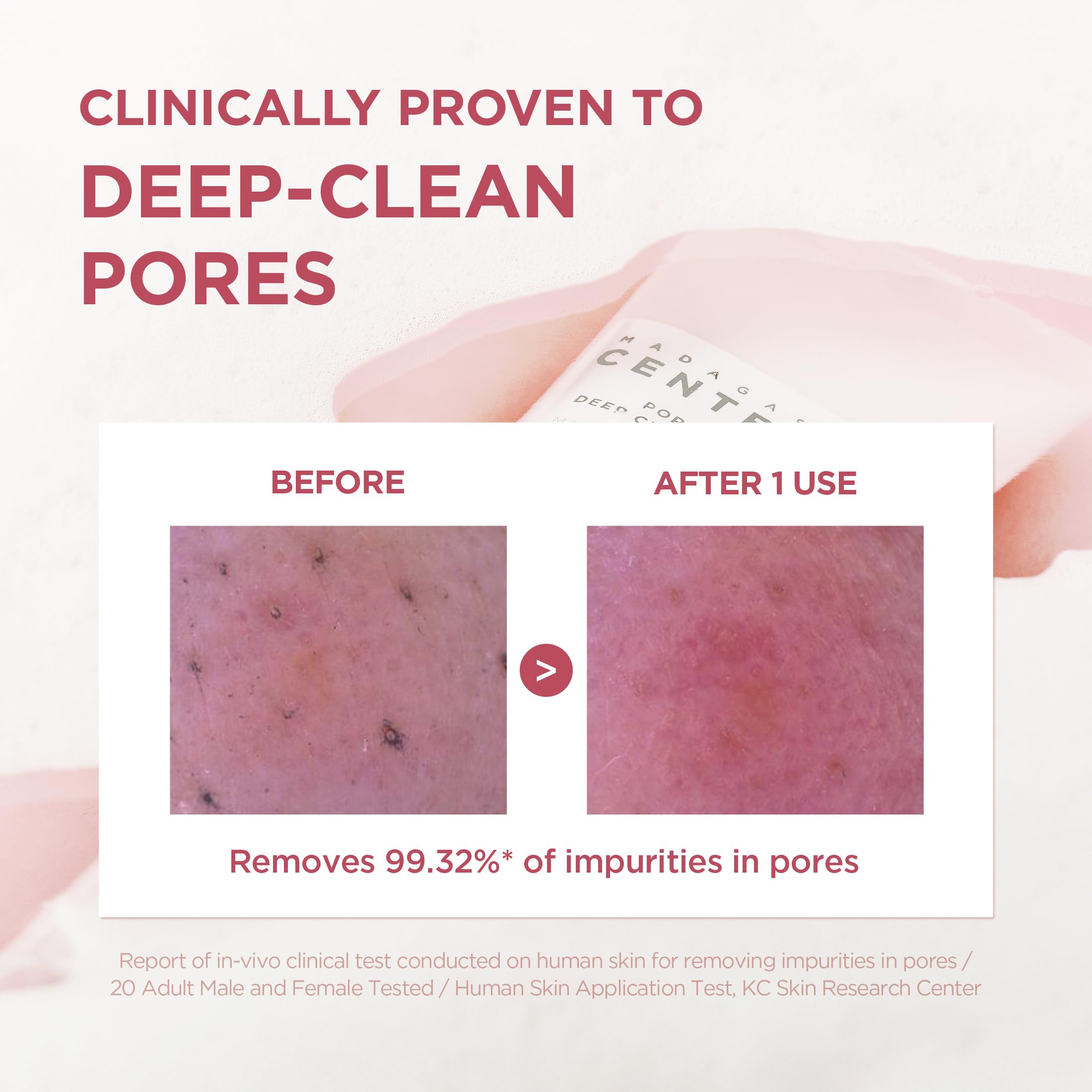 SKIN1004 Poremizing Deep Cleansing Foam, 4.23 fl.oz, 125ml, Makeup Remover, Korean Face Cleanser with Himalayan Pink Salt & Madagascar Centella Asiatica for Facial Pore Cleansing, Korean Skin Care