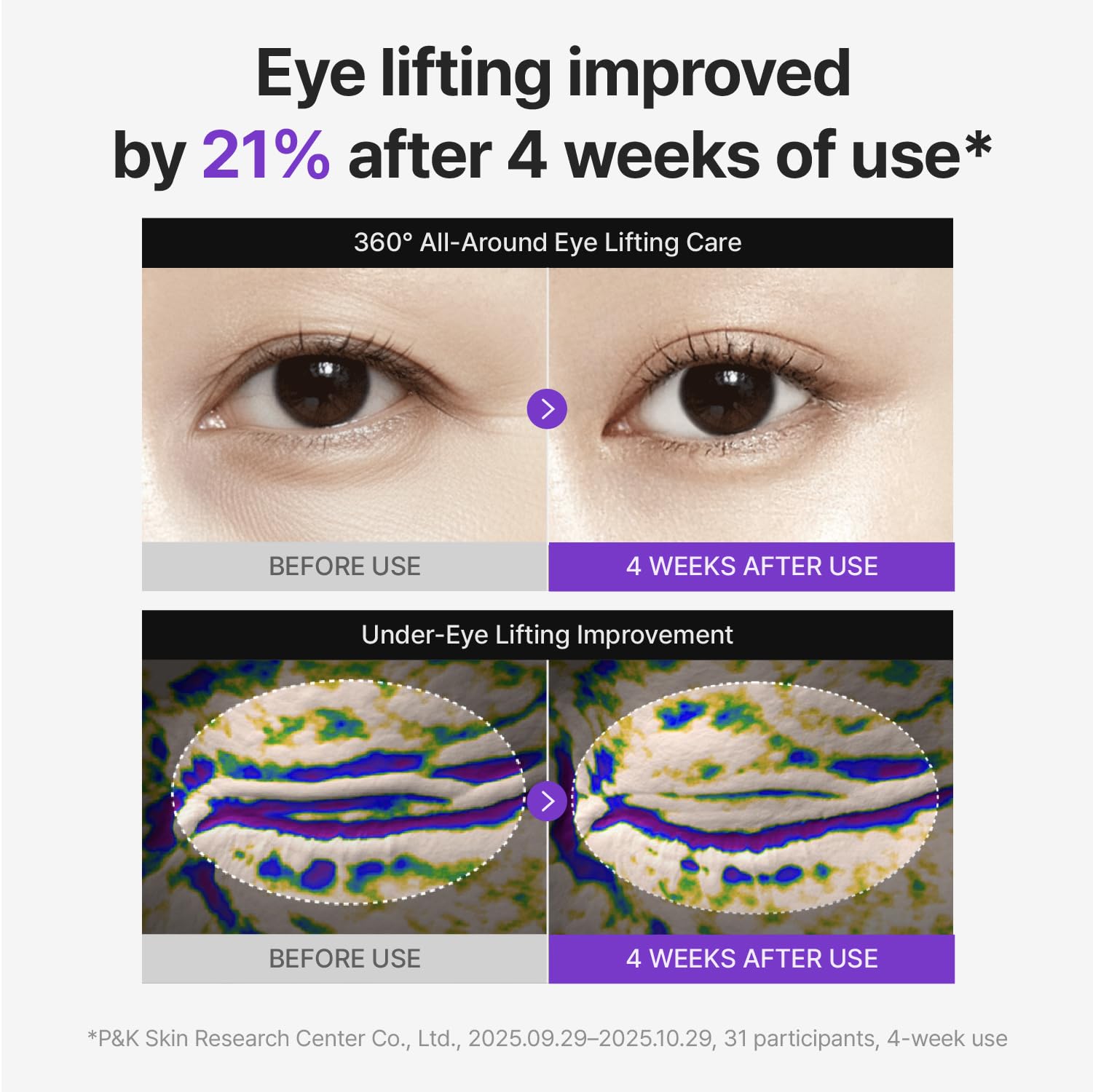 CENTELLIAN 24 360º Shot PDRN Eye Cream - TECA, Retinol and Collagen