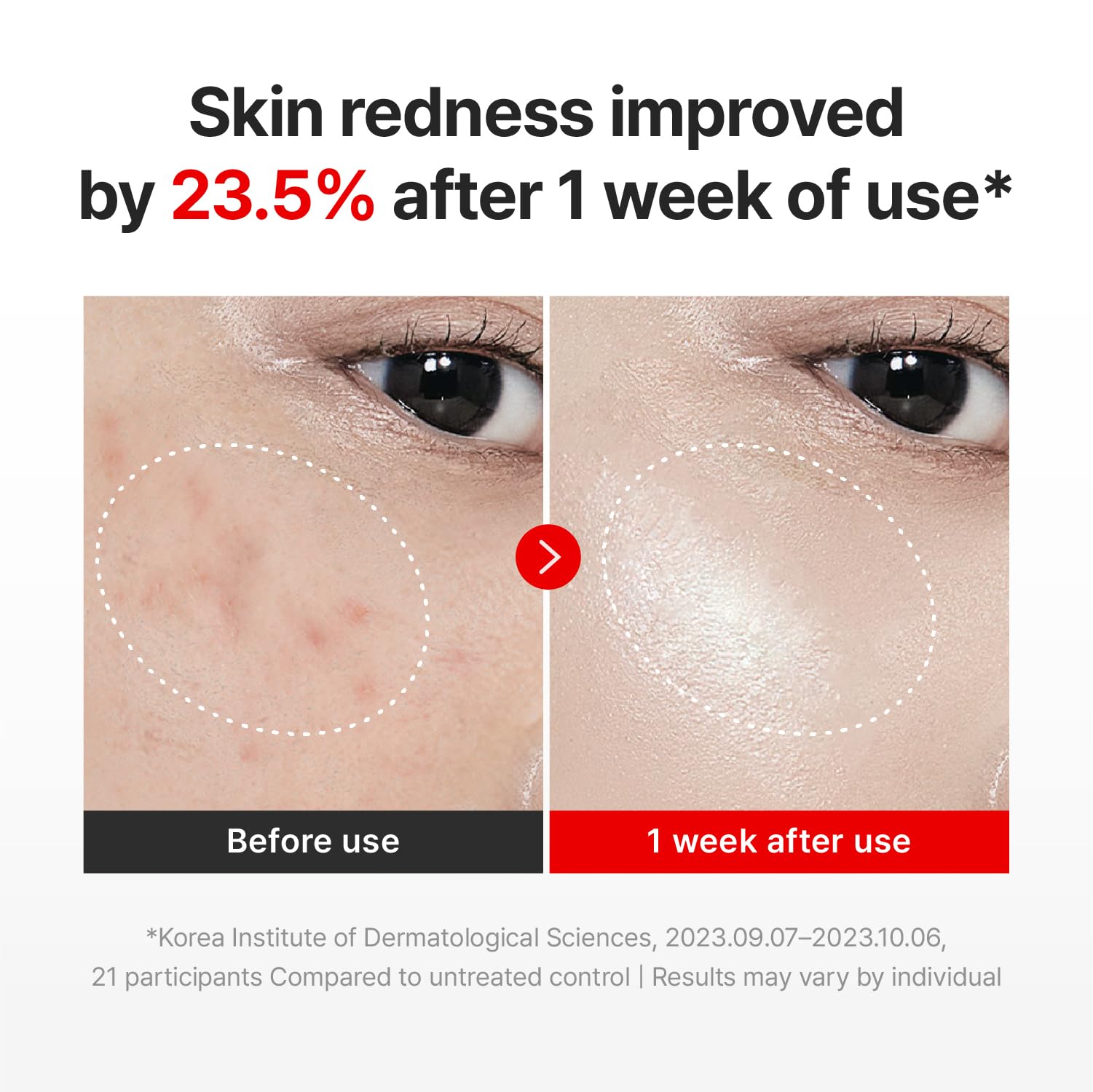 CENTELLIAN 24 Madeca Cream Time Reverse Korean Face Moisturizer Duo