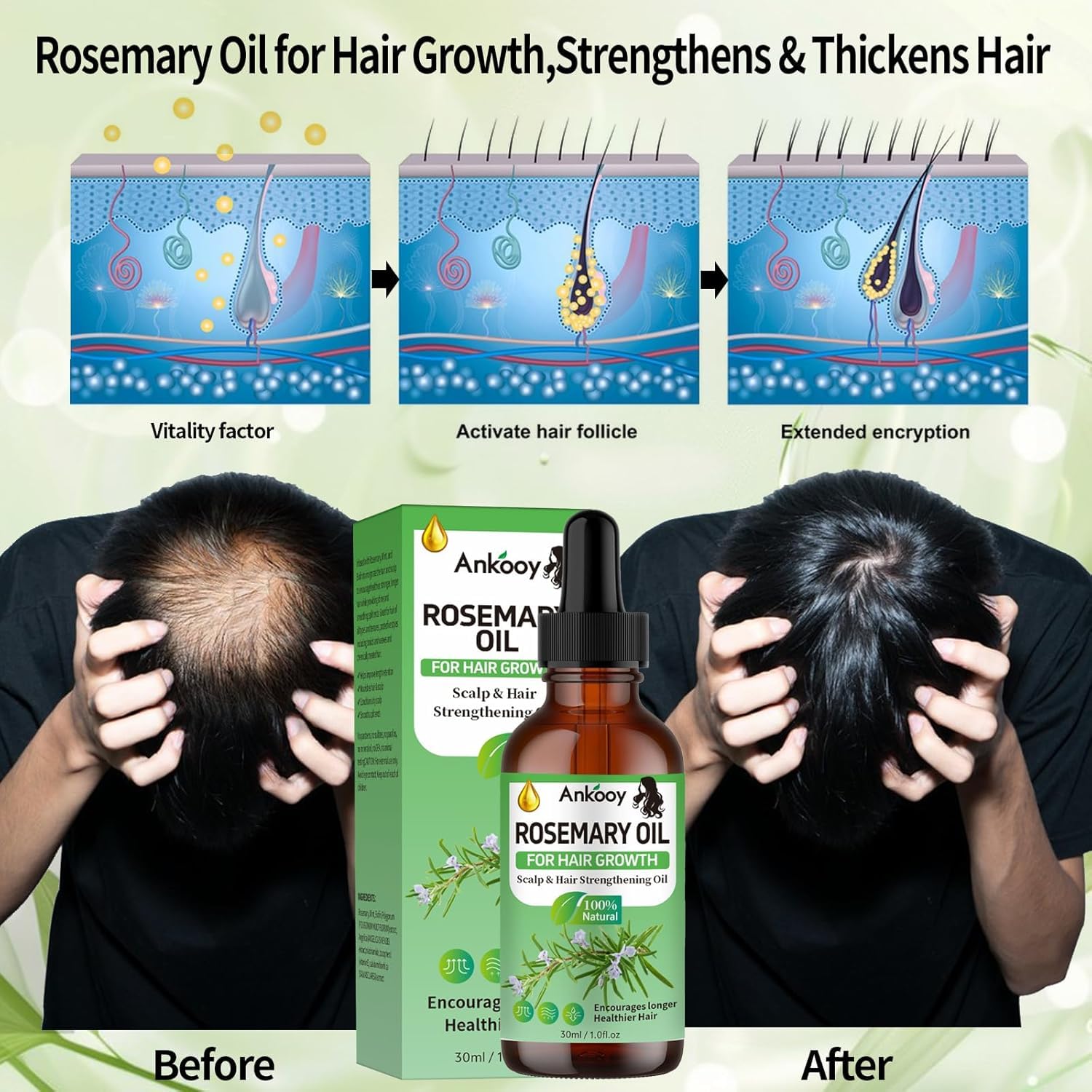Batana Oil for Hair Growth & Rosemary Oil for Hair Growth,Raw Batana Hair Mask Rosemary Hair Growth Serum,Hair Oil for Dry Damaged Hair,Promotes Hair Thickness for Men Women
