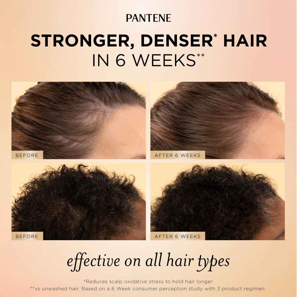 Pantene Abundant & Strong Daily Scalp Serum, Strengthens Scalp’s Hold on Roots, 2 oz