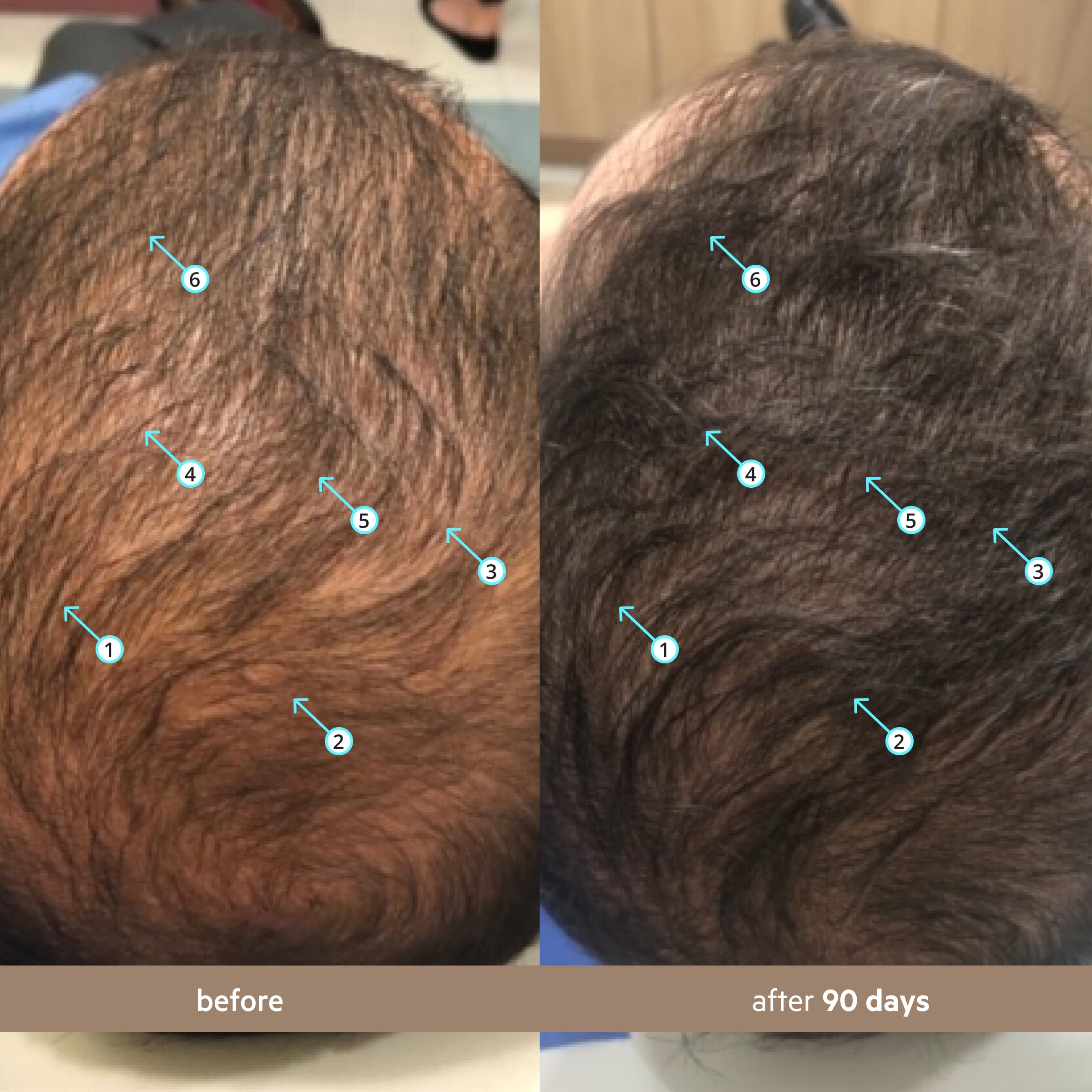 Spectral DNC-N by DS Laboratories Hair Loss and Thinning Hair Product - DHT Blocker, Anti Hair Loss Treatment, Hair Growth for Thicker, Fuller Hair, Water Based Formula