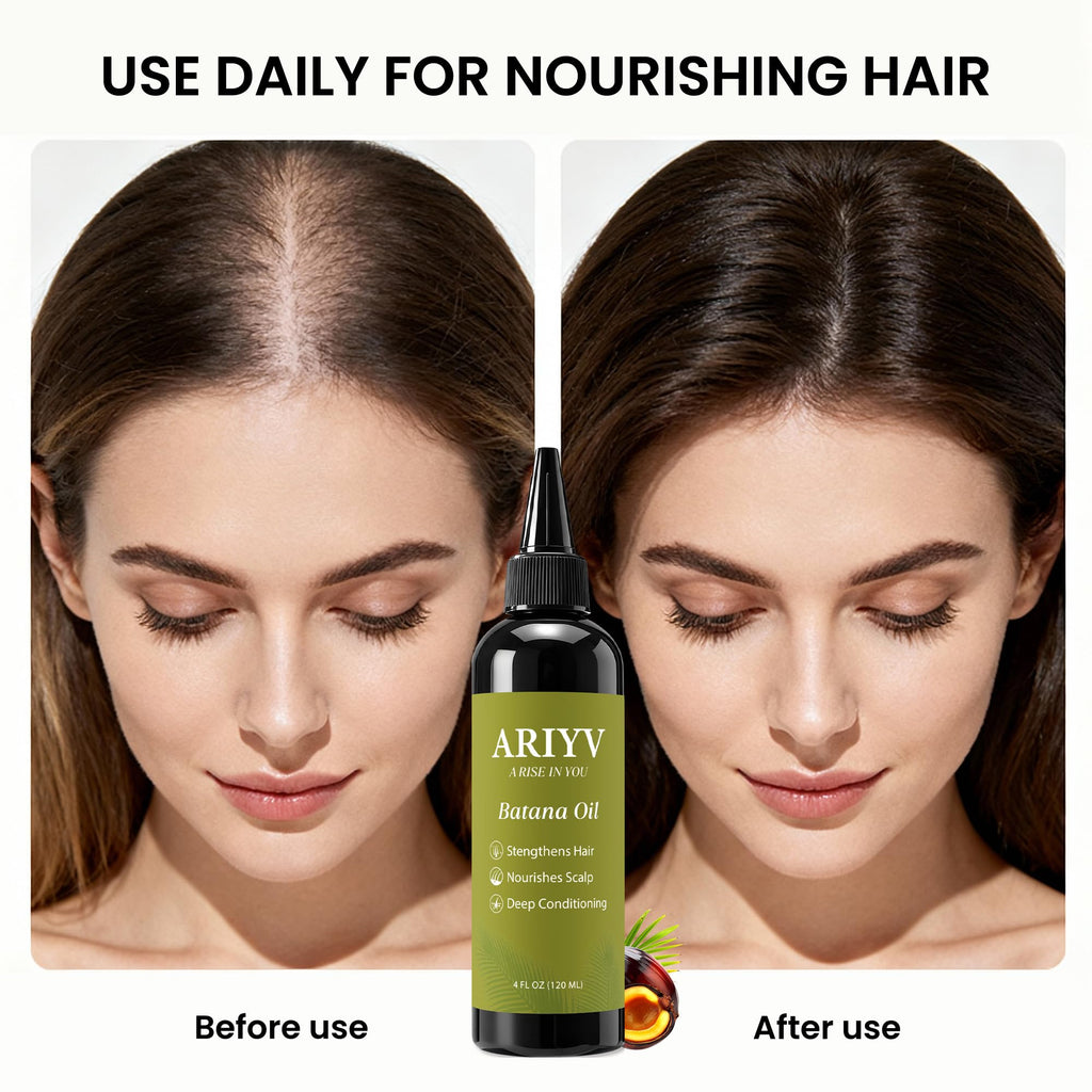 Ariyv Batana Oil for Hair Growth, Natural Batana Oil - Prevents Hair Loss, Reduces Breakage and Strengthens Hair, Enhances Thickness for Men & Women