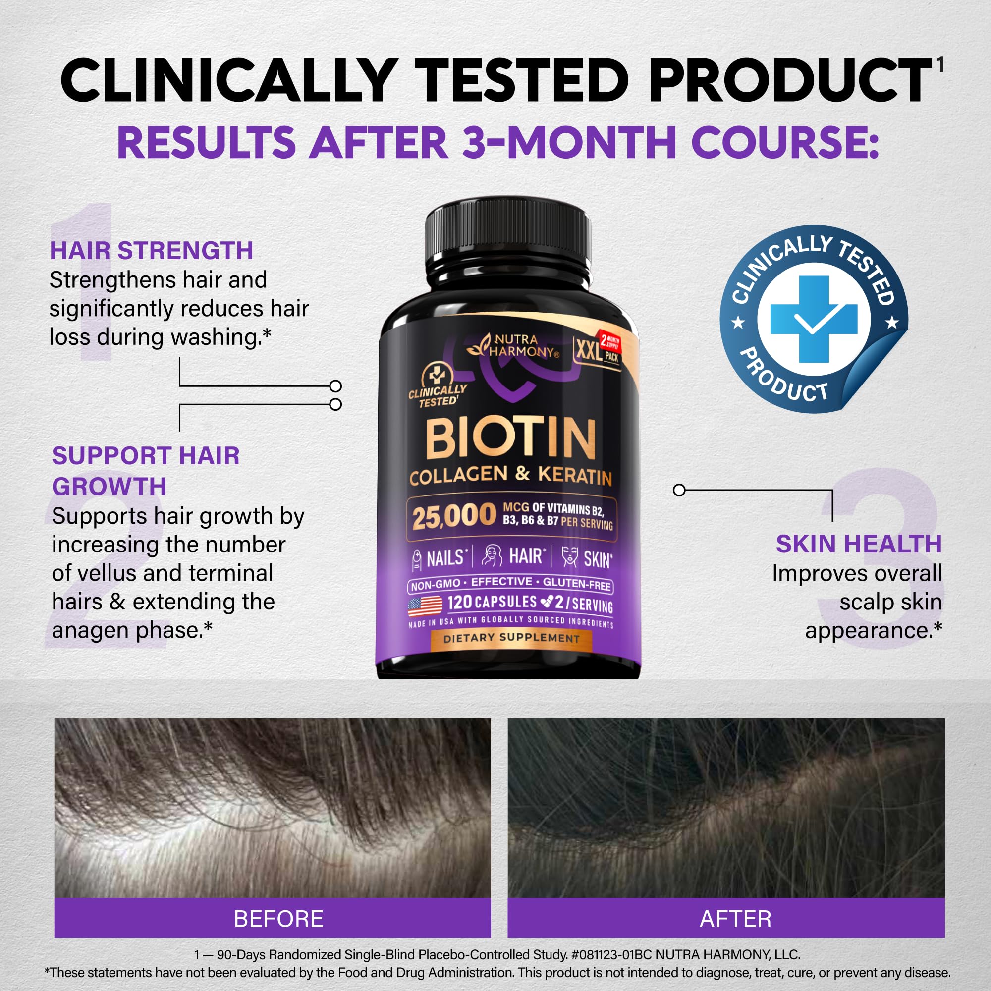 Biotin | Collagen | Hyaluronic Acid | Keratin - Support Normal Hair Growth Cycle, Skin & Nails - Clinically Tested - 25000mcg Vitamins B1, B2, B3, B6 & B7 - for Women & Men - 120 Capsules