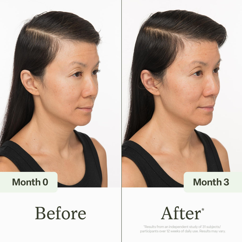 Divi Scalp Serum | To Promote Fuller-Looking Hair with Peptides | 30ml