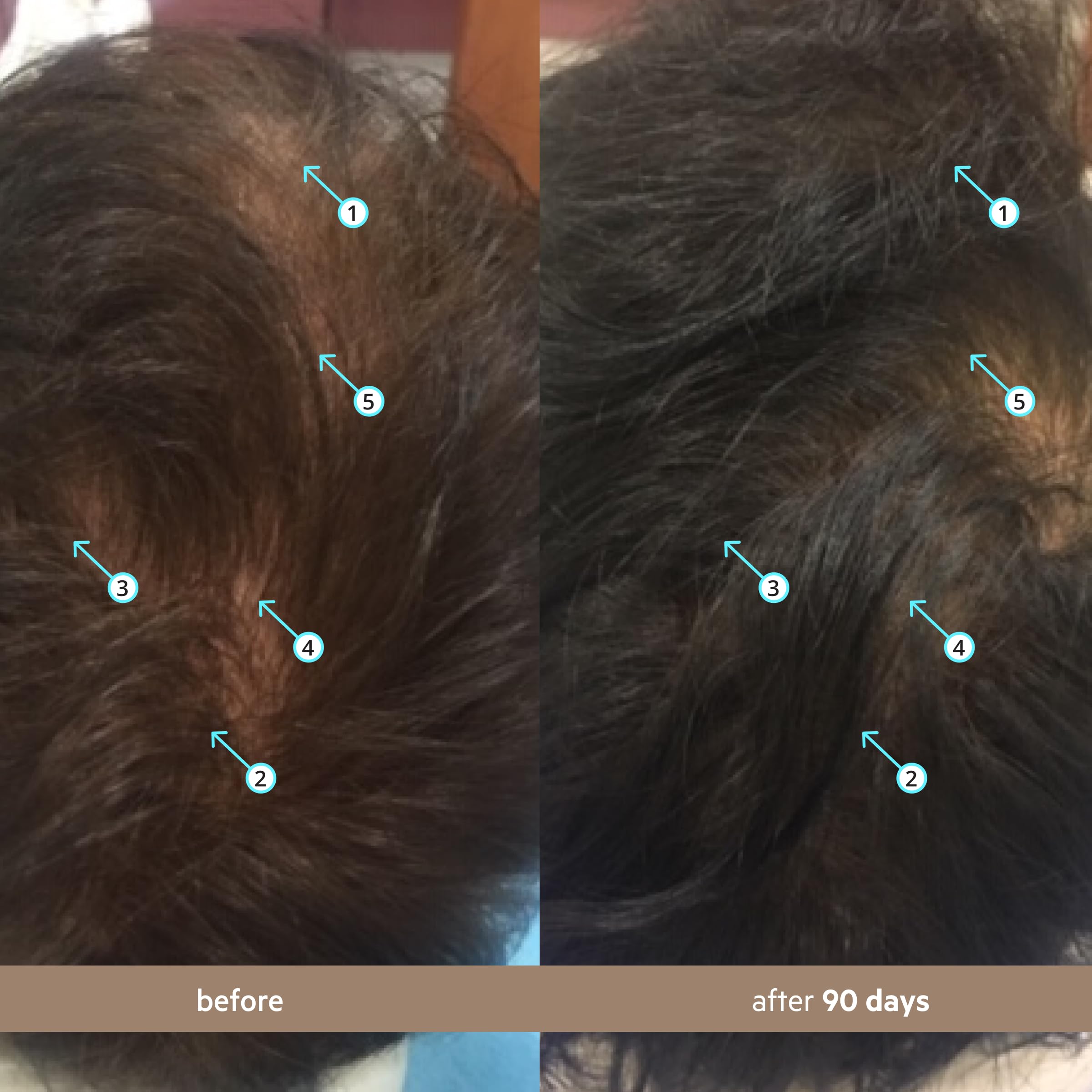 Spectral DNC-N by DS Laboratories Hair Loss and Thinning Hair Product - DHT Blocker, Anti Hair Loss Treatment, Hair Growth for Thicker, Fuller Hair, Water Based Formula