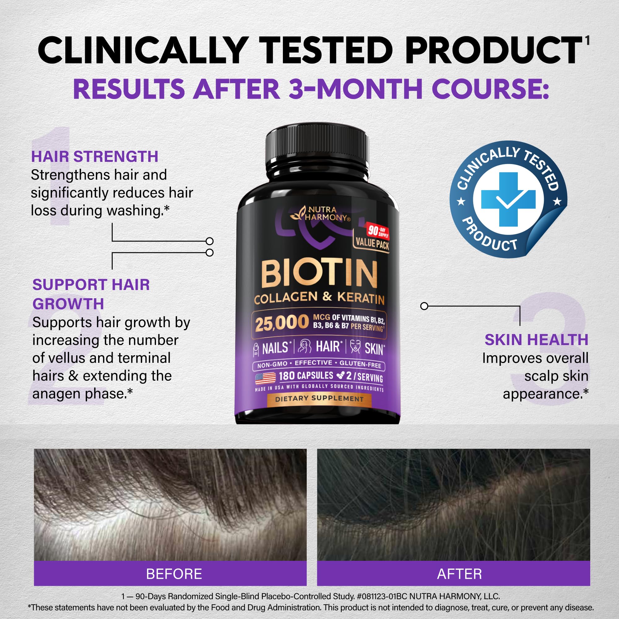 Biotin | Collagen | Hyaluronic Acid | Keratin - Support Normal Hair Growth Cycle, Skin & Nails - Clinically Tested - 25000mcg Vitamins B1, B2, B3, B6 & B7 - for Women & Men - 180 Capsules