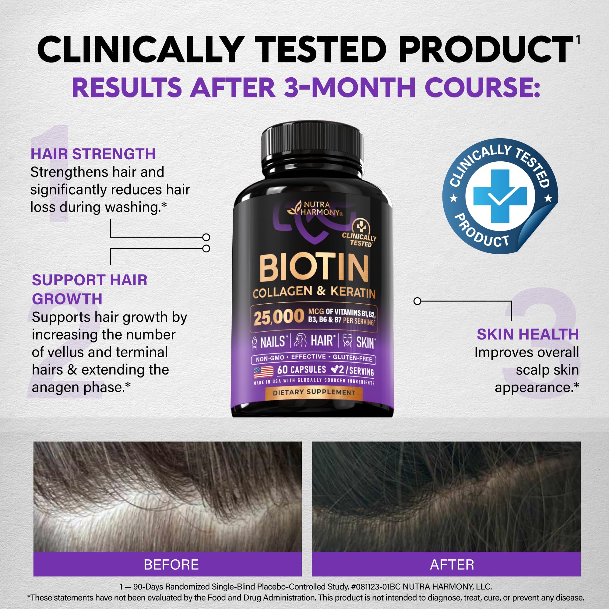 Biotin | Collagen | Hyaluronic Acid | Keratin - Hair Growth & Strength Support Vitamins - Skin & Nails Supplement - Clinically Tested for Men & Women - 25000mcg Vitamins B1, B2, B3, B6 & B7 - 60 Caps